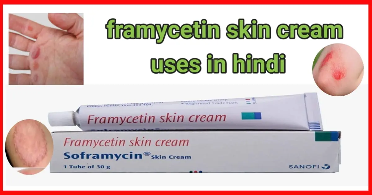 framycetin skin cream uses in hindi